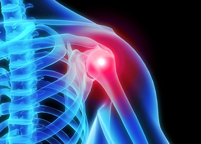 shoulder pain